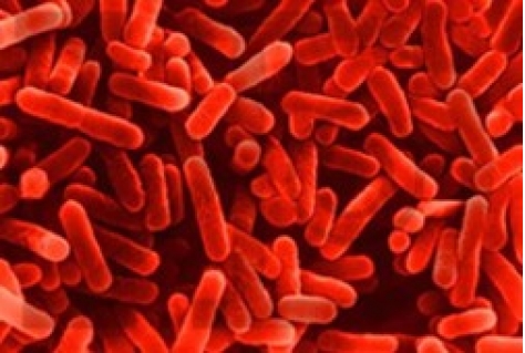 Legionella bij honderden toeristische accommodaties